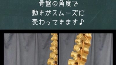 股関節痛でお悩みの方へ★必見★特に＜反り腰の方＞は注目です！