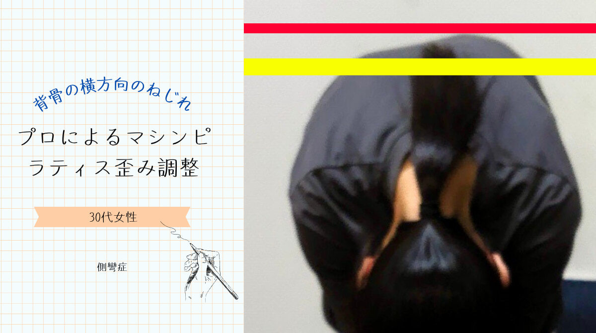 当スタジオに、30代女性のクライアント様が「側弯症」のお悩みでいらっしゃいました。
