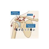 肩が凸って痛い💦